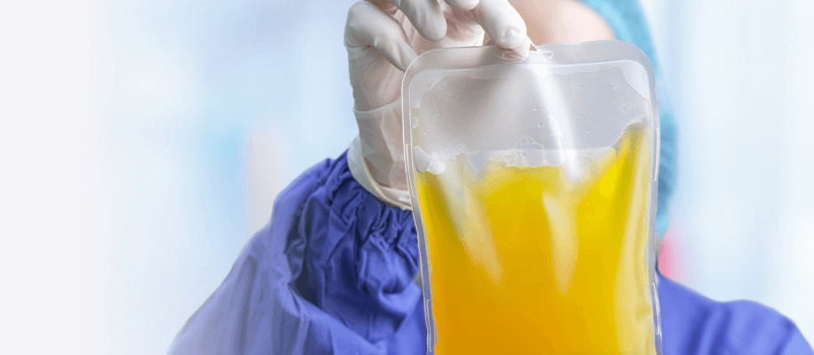 What are the Most Common Uses of Donated Plasma?