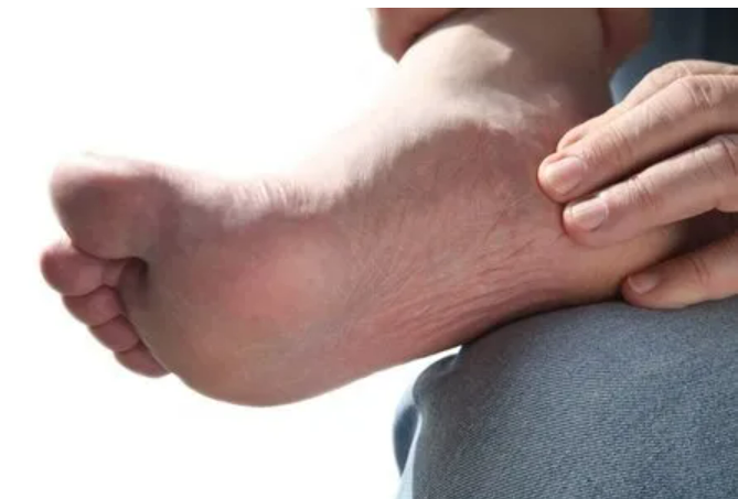arthritis pain in foot