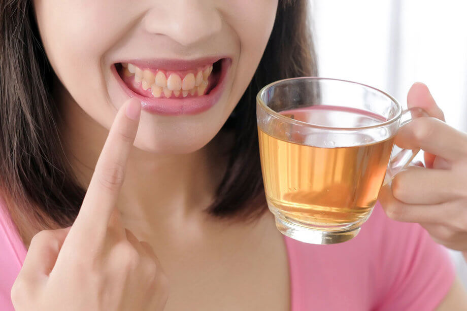 How To Remove Coffee Stains From Your Teeth
